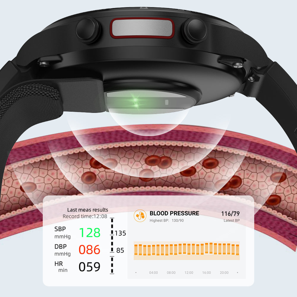 P70 Air Pump + Airbag Oscillometric Blood Pressure Smartwatch with Atrial Monitoring