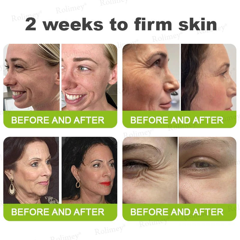 👏🌿 Made in the USA direct shipping 💫 Tiworld® Botox Vitamin A Retinol Anti-Wrinkle Firming and Lifting Cream — Last Day for Limited Time 70% OFF