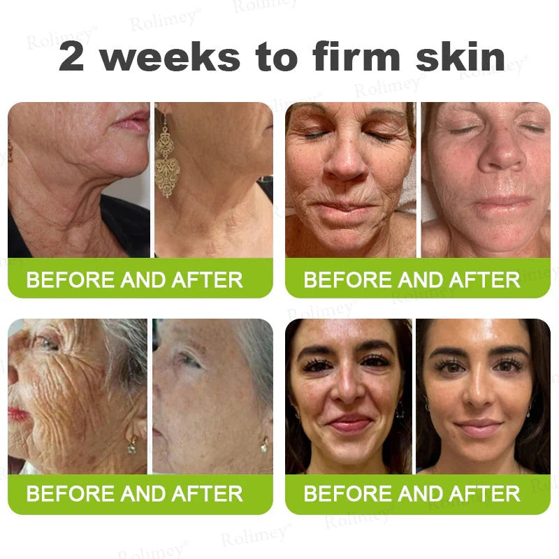👏🌿 Made in the USA direct shipping 💫 Tiworld® Botox Vitamin A Retinol Anti-Wrinkle Firming and Lifting Cream — Last Day for Limited Time 70% OFF