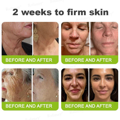 👏🌿 Made in the USA direct shipping 💫 Tiworld® Botox Vitamin A Retinol Anti-Wrinkle Firming and Lifting Cream — Last Day for Limited Time 70% OFF