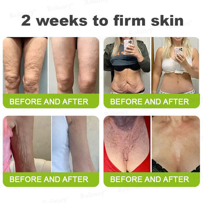 👏🌿 Made in the USA direct shipping 💫 Tiworld® Botox Vitamin A Retinol Anti-Wrinkle Firming and Lifting Cream — Last Day for Limited Time 70% OFF